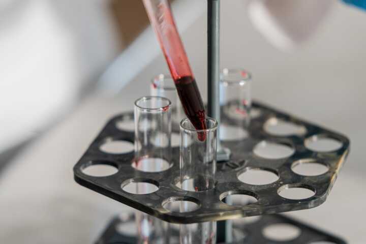 Free stock photo of biochemistry, biology, chemical